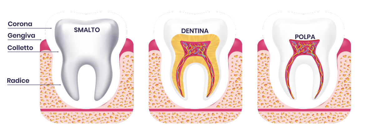 schema-denti