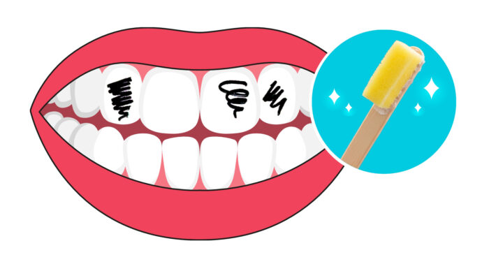 Missione denti puliti